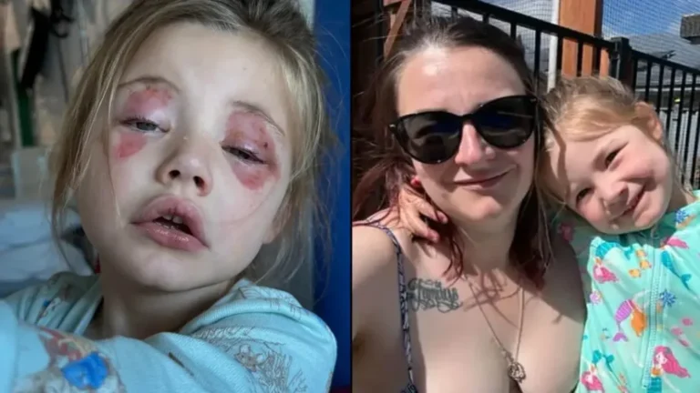 A 4-year-old girl is blinded after biting a common household item.